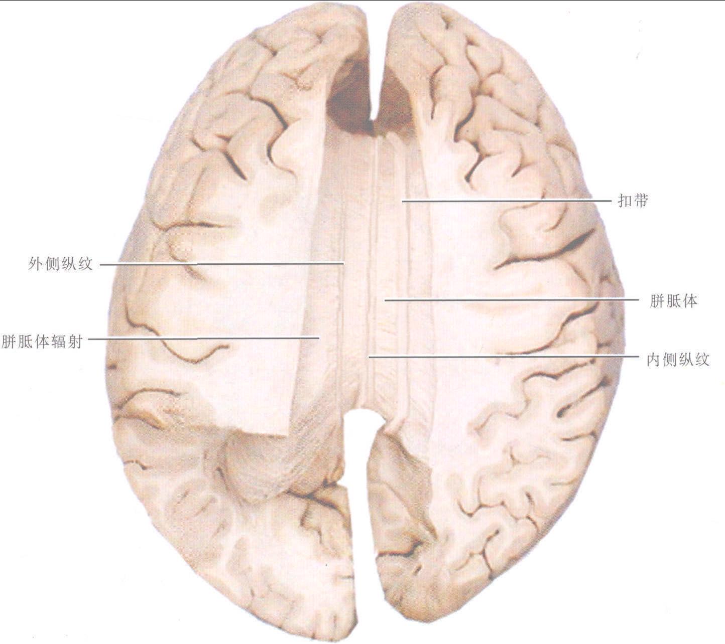 图5-1-47 大脑半球的连合纤维(示胼胝体)